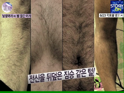 남자보다 털이 더 수북한 여자