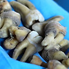 건물속 대량의 인간의 치아가 발견된 미스테리