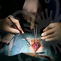 남자무턱필러, 과연 효과적일까? 💉🤔