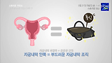 [선공개_3화]그녀들의 두번째 심장! 자궁의 모든 것! 바로가기