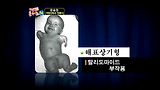 제 43강(4) - 건강상식의 불편한 진실과 올바른 건강법