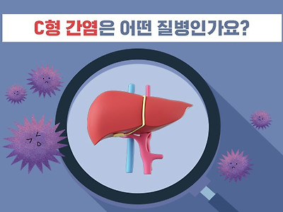 C형 간염의 증상, 감염경로 및 치료방법에 대한 정리