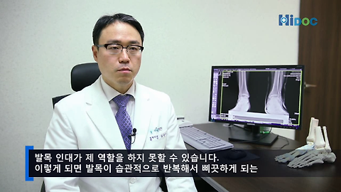 삐끗한 발목 방치했더니… 만성 불안정성 발목으로!