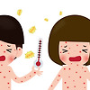 수족구 증상 5가지 알아보기! (예방법, 치료방법, 유행시기)