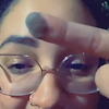비키니라인 피부로 손가락에 피부 이식을 한 여성에게 나타난 놀라운 일