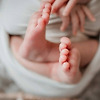 브라질에서 "진짜 꼬리" 달린 아기 탄생