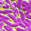 플로리다의 식인 박테리아! 8명이 감염 중 2명이 사망