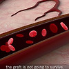 혈관을 갖춘 "살아있는 피부"를 3D 프린터로 제작 성공