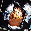 초음파로 뇌를 자극해 세포를 활성화 시키는 방법 발견