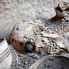 세계에서 가장 오래된 4800년 전의 의안