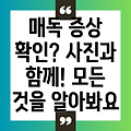 남자 매독 증상 사진과 함께 알아보는 매독의 모든 것