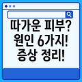 피부가 따가운 원인 6가지와 증상 정리