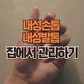 내성손톱 내성발톱 원인 치료 집에서 관리하는 방법