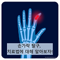 손가락 탈구: 병원에 꼭 방문해야 하는 이유?!