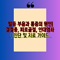 발등 부음과 통증의 원인| 결절종, 피로골절, 인대염좌 | 진단 및 치료 가이드