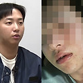 “김하성이 술만 먹으면 때렸다”…신상 밝히고 폭행사진 공개한 임혜동