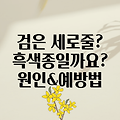 손톱 검은 세로줄: 흑색종일까요? 원인과 진단, 그리고 예방법까지 알아보아요!