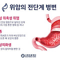 [건강 정보] 위용종이 발생하는 원인과 위에 좋은 식습관