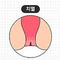 치핵: 소개, 설명, 증상, 치료