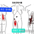 요통과 콩팥(신장) 관계