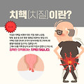 [건강 정보]치질의 정의와 종류: 건강한 항문을 위한 필독서