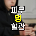 자주 멍이 드는 이유와 효과적인 대처 방법
