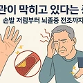 혈관이 막히고 있다는 증거｜손발 저림부터 뇌졸중 전조까지
