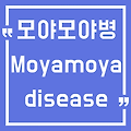 [Moyamoya disease] 모야모야병이란? 증상 원인 치료법