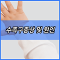 수족구증상 및 원인 | 잠복기 전염 | 초기증상 | 열날때 | 입원 | 어린이집 | 유행시기 | 안옮는 꿀팁 | 좋은음식 나쁜음식 2024