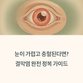 눈이 가렵고 충혈된다면? 결막염 완전 정복 가이드