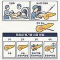 췌장암 검사 방법 및 병기별 치료 방법