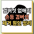 검버섯 없애는법 | 검버섯 제거 | 손등 검버섯 | 검버섯원인 총정리