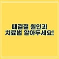폐결절 원인과 치료법 알아두세요!