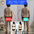 해독은 장기만의 역할이 아니다? – 경피독과 피부 해독의 과학적 진실