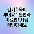 감기 증상과 목 림프절 부음: 원인, 증상, 치료법 알아보기