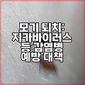 모기 퇴치: 지카바이러스 등 감염병 예방 대책