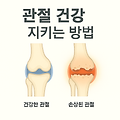 관절 건강 지키는 방법: 효과적인 영양제 선택과 관리법