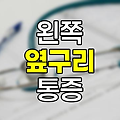 왼쪽 옆구리 통증 원인 상세 분석 및 관리법