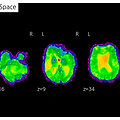 [Medical] - FSL로 fMRI 와 MRI 데이터를 분석해보자