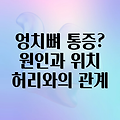 엉치뼈 통증의 모든 것: 위치, 원인, 그리고 허리 통증과의 관계