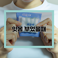 잇몸 부었을때, 이렇게 대처하세요!