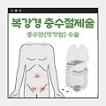 [복강경 충수절제술 후기(2)] 충수염(맹장염) 수술 후기