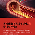 동맥경화, 침묵의 살인자: 원인, 증상 및 예방법