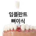 임플란트 뼈이식 가격 비용 싼곳 잘하는곳 찾기 추천 | 구멍 | 종류 | 기간 | 후기 | 경남 | 경북 | 전남 | 전북 | 충남 | 충북