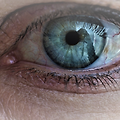 눈 안쪽 이물감의 원인과 예방 및 치료 방법