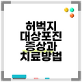 허벅지 대상포진 증상과 치료방법