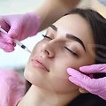 Acne extraction in melasma care