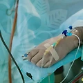 코병원, 성형수술의 화려한 이면과 치명적인 부작용
