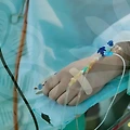 성형 수술: 기대와 현실의 간극을 알아보자!