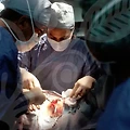 원주리프팅과 성형: 변화를 꿈꾸는 당신에게